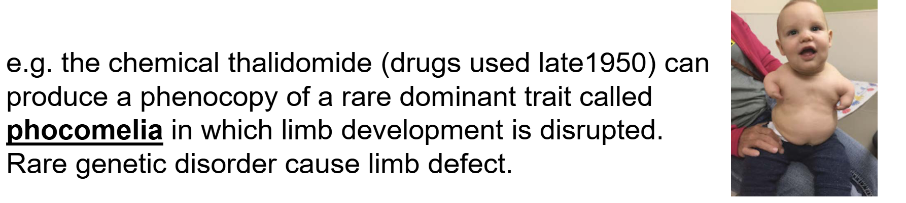 <ul><li><p>A <strong>phenocopy</strong> is a phenotype caused by an <strong>environmental factor</strong> that <strong>mimics the phenotype normally caused by a genetic mutation</strong>.</p></li><li><p>The individual does <strong>not need to have the mutation</strong> that normally produces the phenotype—the environment produces a similar effect.</p></li><li><p>Example: exposure to <strong>thalidomide during fetal development</strong> can disrupt limb development, producing a phenotype similar to the genetic condition <strong>phocomelia</strong>.</p></li><li><p><strong>Key idea:</strong> Phenocopy = <strong>environment produces a phenotype that looks genetically caused</strong>.</p></li></ul><p></p>