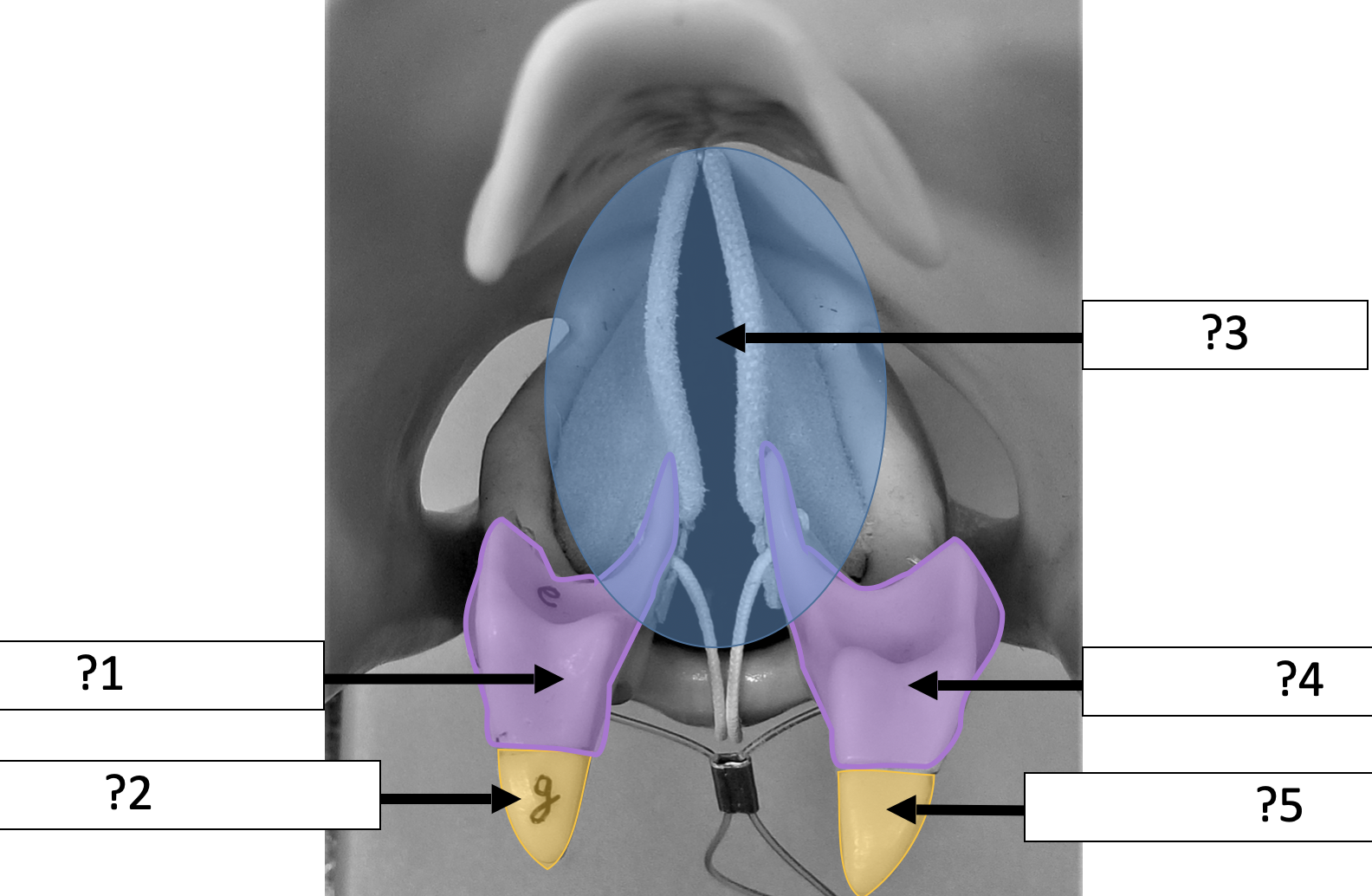 <p>1 Name the structure? </p>