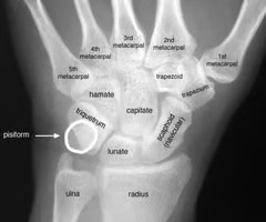 <p>hamate= unciform capitate= os magnum trapezoid= lesser multangular trapezium= greater multangular triquetrum lunate= semi lunar scaphoid= navicular pisiform</p>