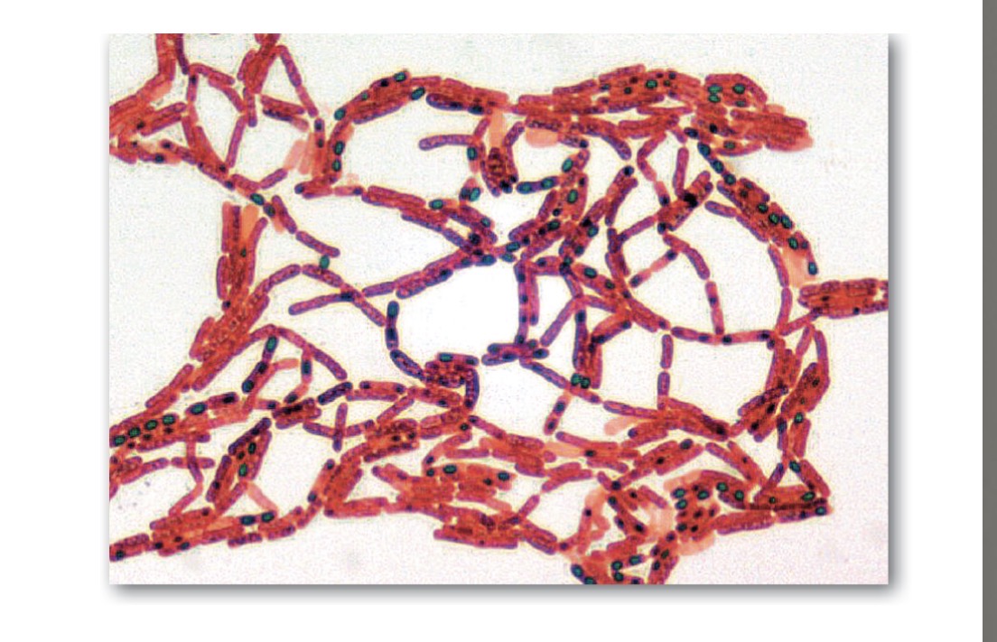 <p>Endospore stain</p>