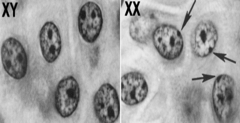 <p>What is being pointed to?</p>