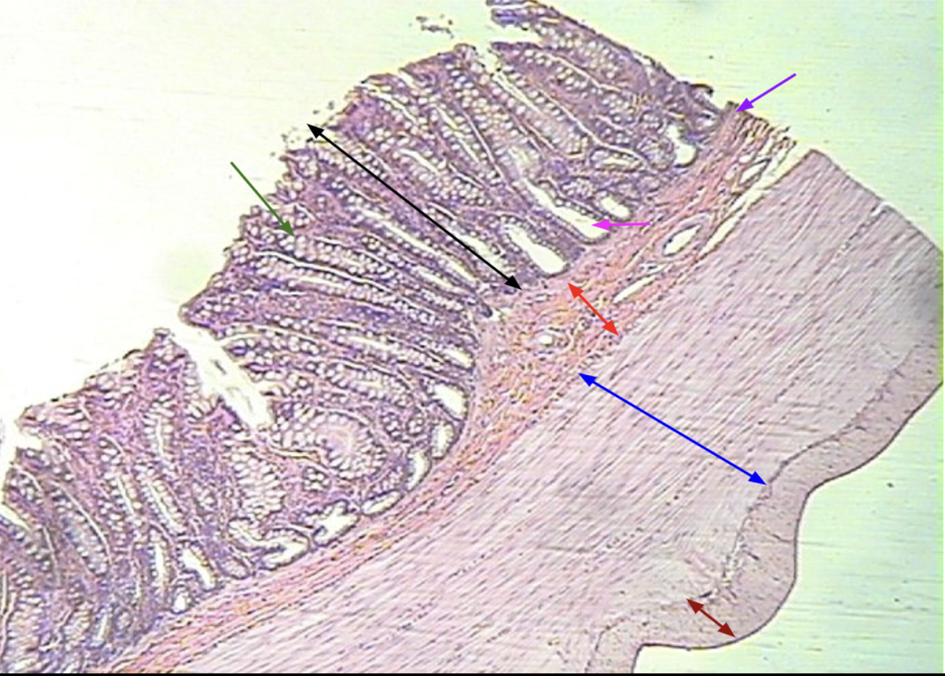 <p>What organ is this? Identify. </p>