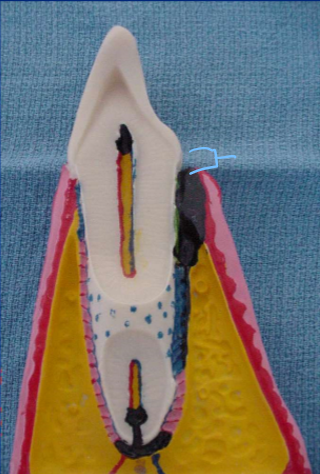 <p>This portion is called the __</p>