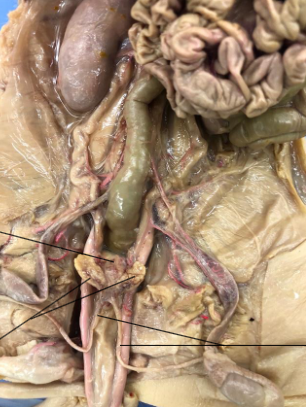 <p>Where is the prostate and what is it’s function?</p>