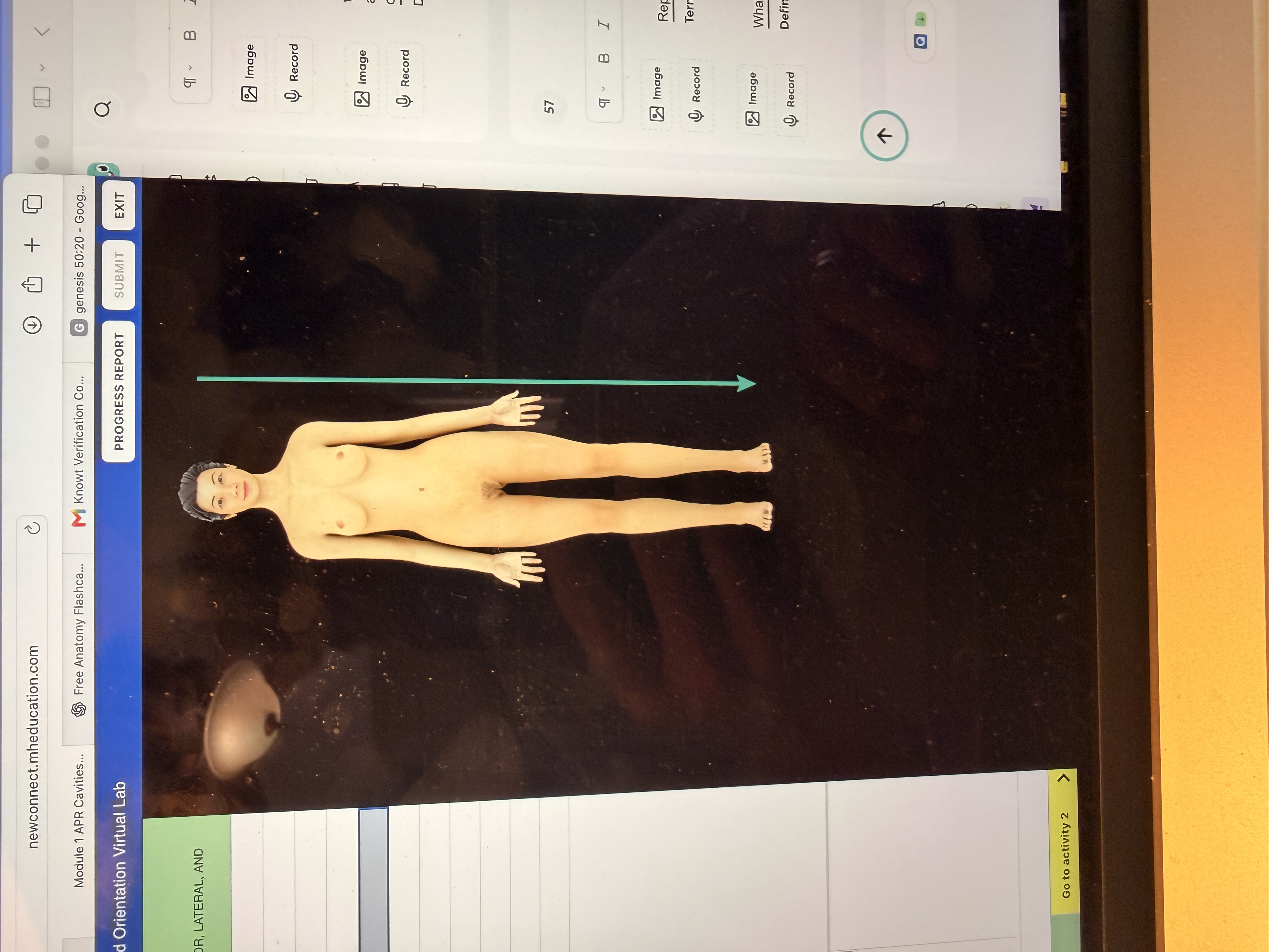<p>What body orientation is this?</p>