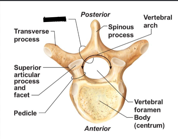 <p>What Boney Feature?</p>