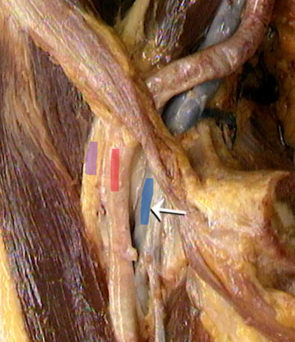 <p>Paars, Rood en Blauw?</p>