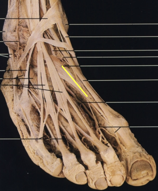 <p>What muscle, layer, action and innervation is this?</p>