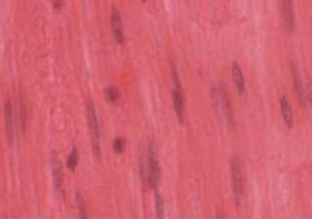 <p>smooth muscle</p>