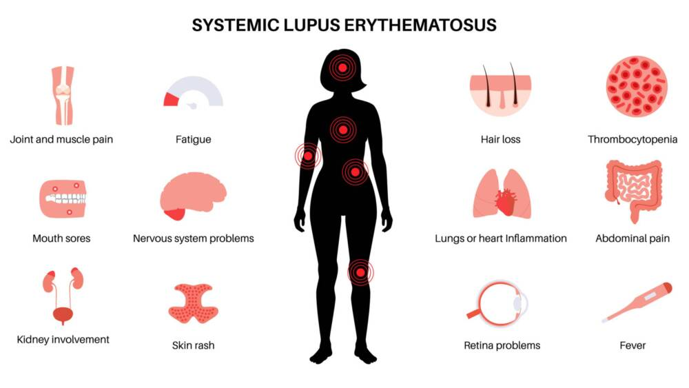 <p>Screening for auto-immune diseases like SLE</p>
