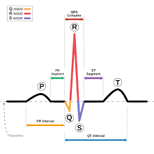 <p>QRS complex: Ventricles squeeze, Ventricle depolarization (electrical activation)</p><ul><li><p>Inverted V on chart (memory trick V = ventricles)</p></li><li><p>Conceals atria repolarization </p></li></ul><p>P wave: Atria squeeze, Atria depolarization (electrical activation)</p><p>T wave: Ventricles relax, ventricle repolarization</p><p></p><p>Depolarization = Contract</p><p>Repolarization = Relax</p>