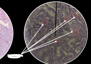 <p>What are the arrows pointing?</p>