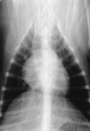 <p>What does this radiograph show?</p>