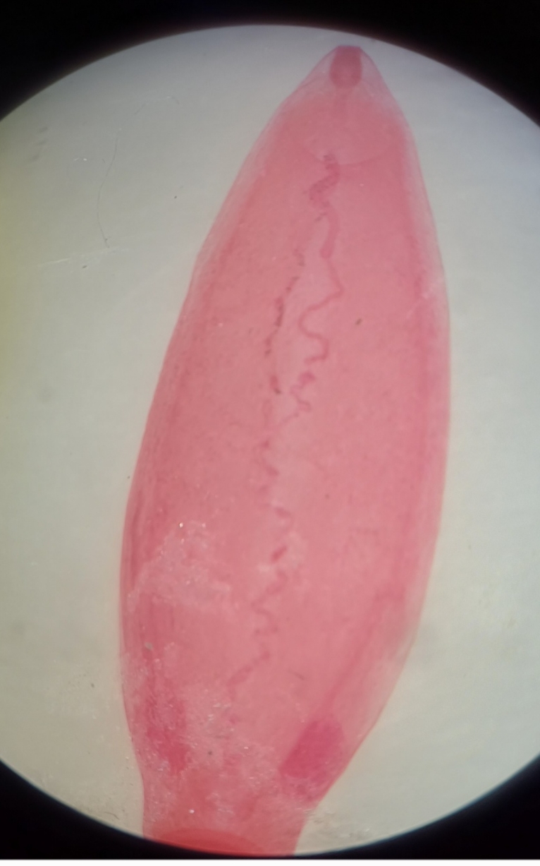 <p>Identification:</p><p>Common name:</p><p>Organ loc:</p><p>Intermediate Host:</p><p>Definitive Host:</p><p>Family:</p>