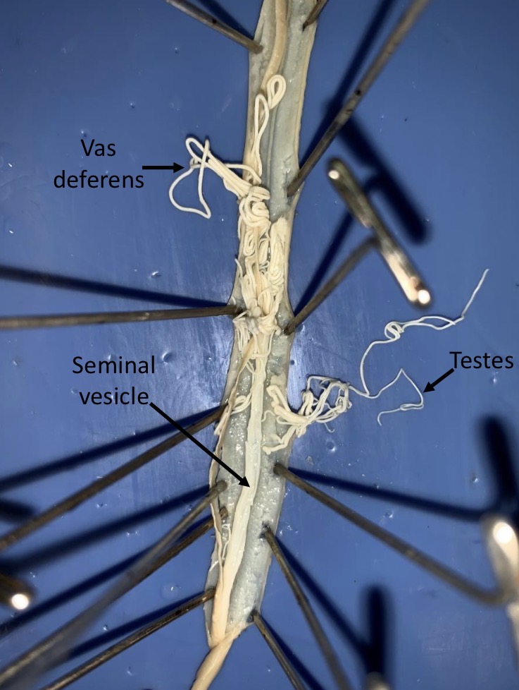 <p>Describe the functions of the copulatory spicule, cloaca, anus, seminal vesicle, sperm ducts/vas deferens and testes in male ascaris</p>