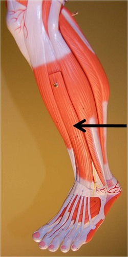 <p>What muscle is this?</p>