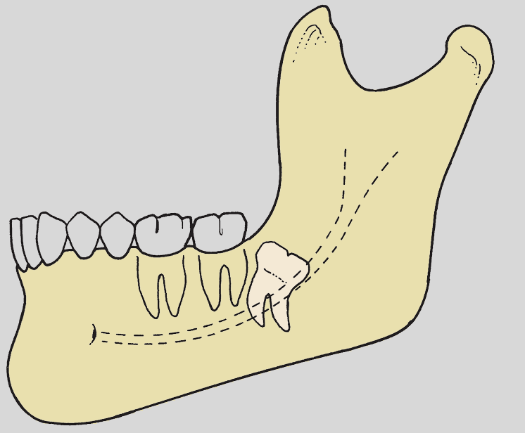 <p>what is the PG classification?</p>