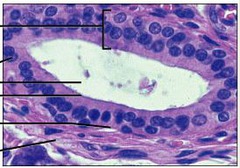 <p>Function: secretion, absorption</p><p>Location: sweat glands, mammary glands</p>