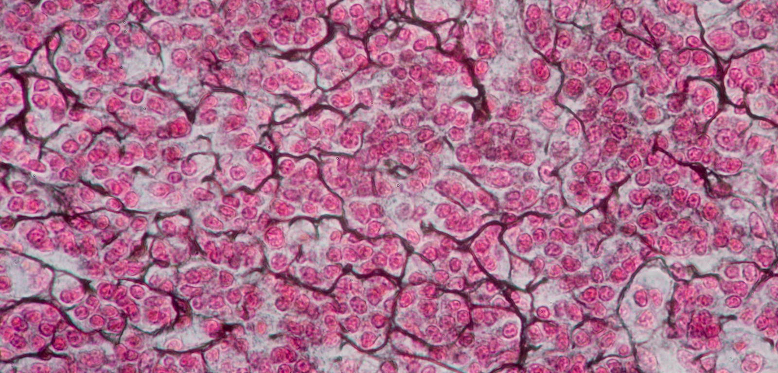 <p>What type of tissue is being depicted in the image? </p>