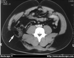 <p>identify the pathology</p>