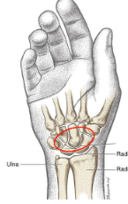 <p>What is this joint?</p>