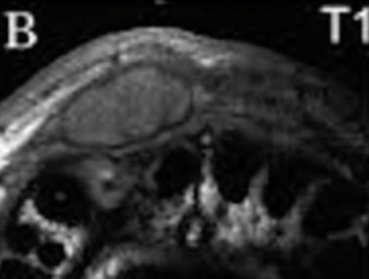 <p>what would be the management? </p>