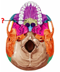 <p>Identify this bone.</p>