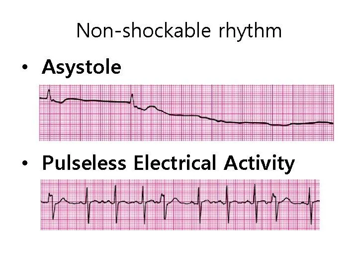 <p>asystole, pulseless electrical activity</p>