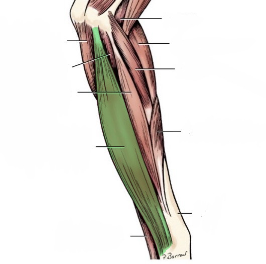 <p>action- flex digits 2-5</p><p>origin- medial epicondyle of humerus (distal)</p><p>insertion- base of phalanges of digits 2-5</p><p>innervation- median n.</p>