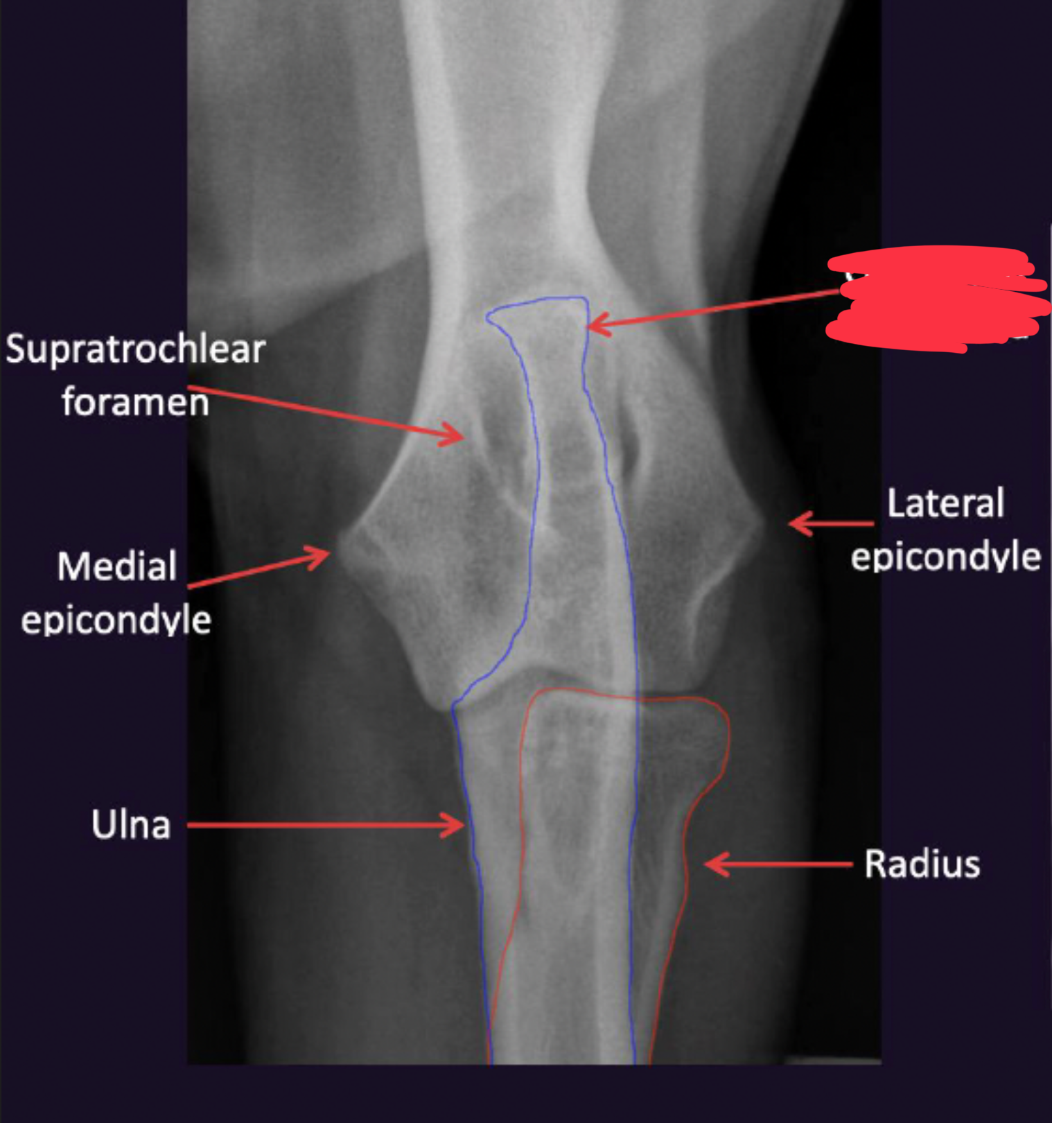 term image