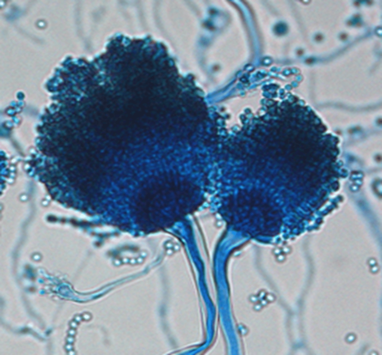 <p>Long chains of conidia</p><p>Unbranched conidiophores with club-shaped vesicle</p>