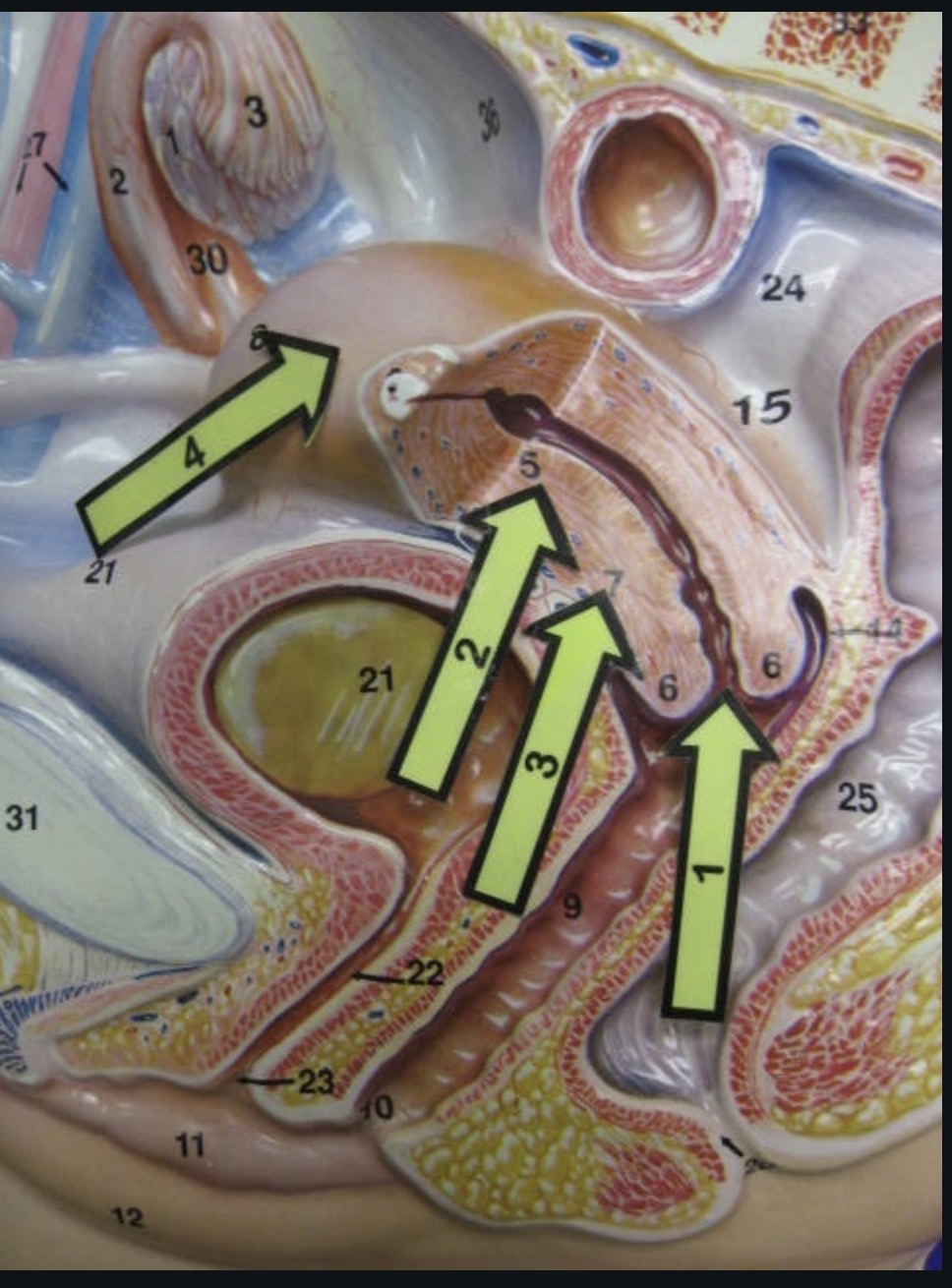 <p>Uterus </p>