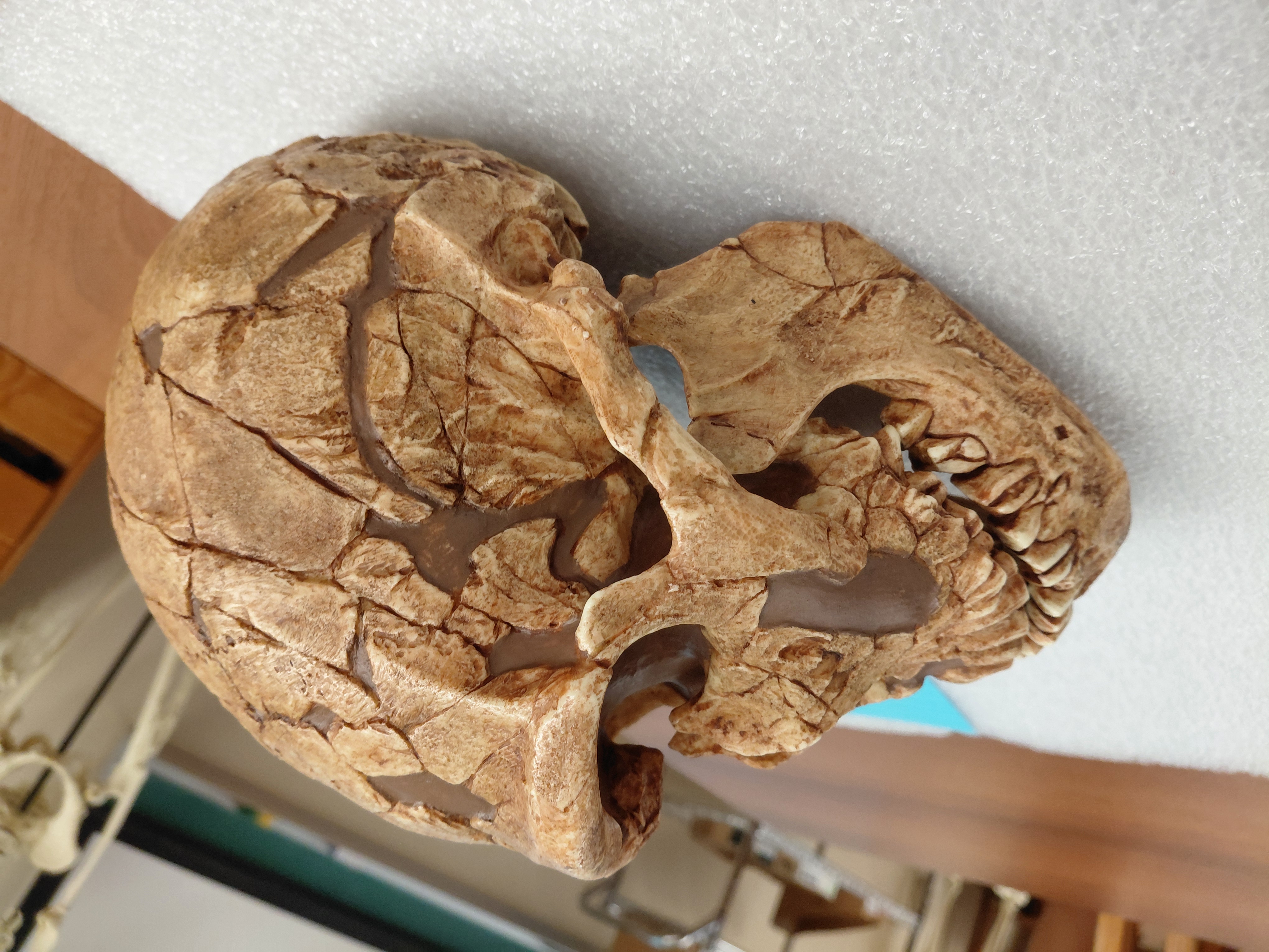 <p>Homo neandertalensis!</p><p></p><p>Distinguishing Features:</p><ul><li><p>Very large brain size</p></li><li><p>Big nasal aperture</p></li><li><p>Retromular gap</p></li><li><p>Occipital bun</p></li><li><p>No chin</p></li><li><p>Long, low skull</p></li><li><p>Mid-facial prognathism</p></li></ul><p></p>