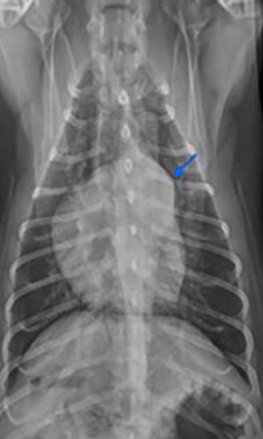 <p>Patent ductus arteriosus</p>