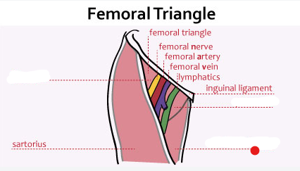 <p>Identify the structure pinned</p>