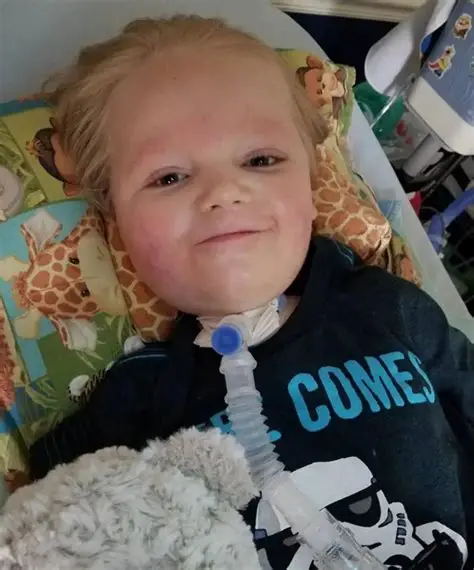 <ol><li><p>burn <span style="color: rgb(92, 190, 27);"><strong>injuries > 80% of</strong></span> body</p></li><li><p>dressing changes to <span style="color: rgb(226, 75, 152);"><strong>face/neck </strong>of <strong>intubated child</strong></span></p></li></ol><ul><li><p>trache care</p></li></ul><p></p>