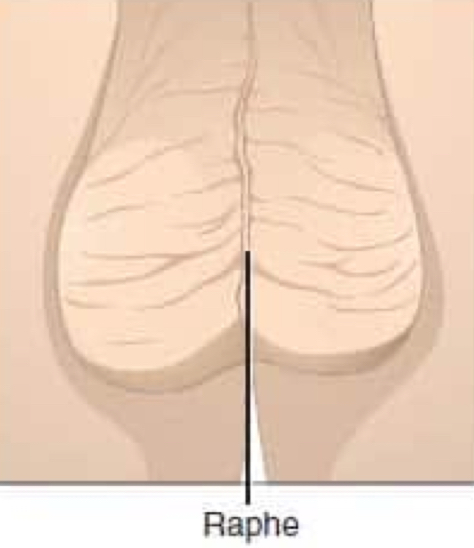 <p>groove, ridge, or seam</p><ul><li><p>divides the scrotum in half</p></li></ul><p></p>