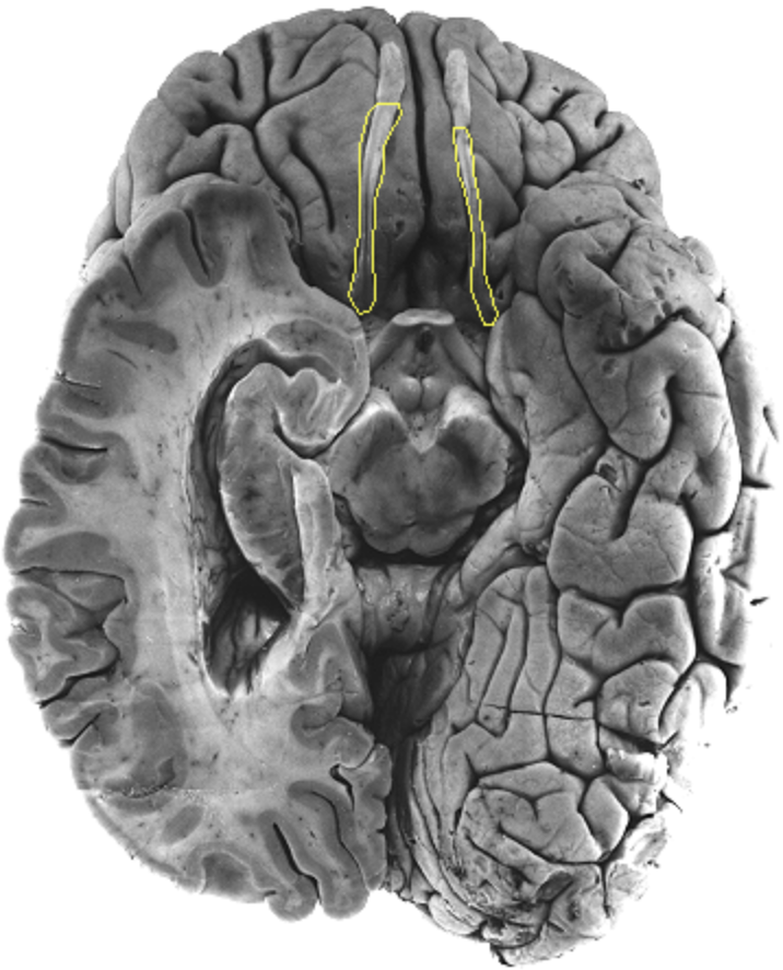 <p>What is the area highlighted called?</p>