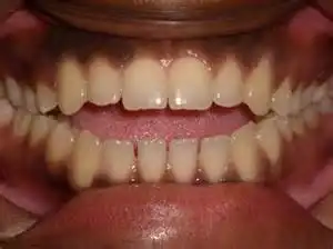 <p>What is the malrelation shown?</p>