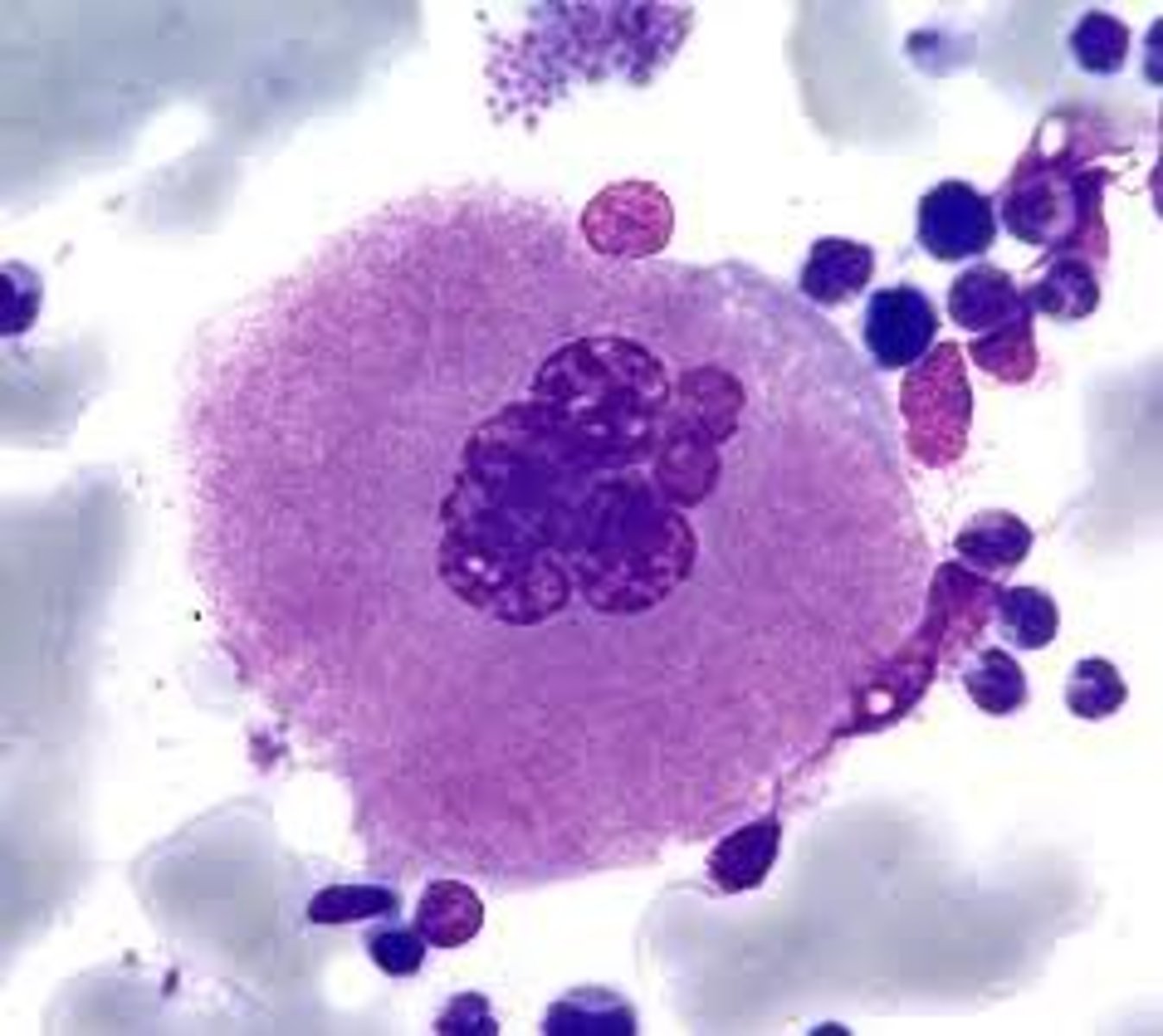<p>large platelet precursor cell found in bone marrow</p>