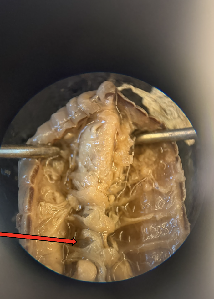 <p>What is this Structure? What is the Function?</p>