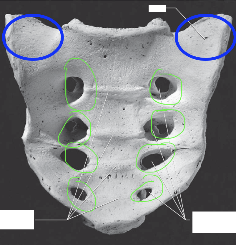 <p>Sacrum: What is the Green?</p>