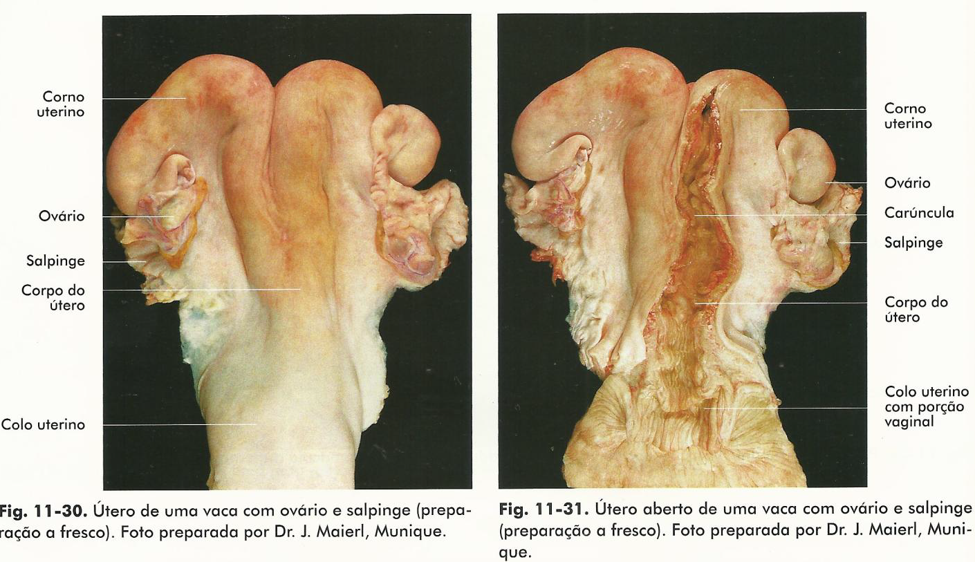<p>Útero bicorno (dois cornos uterinos relativamente longos e corpo uterino curto).</p>