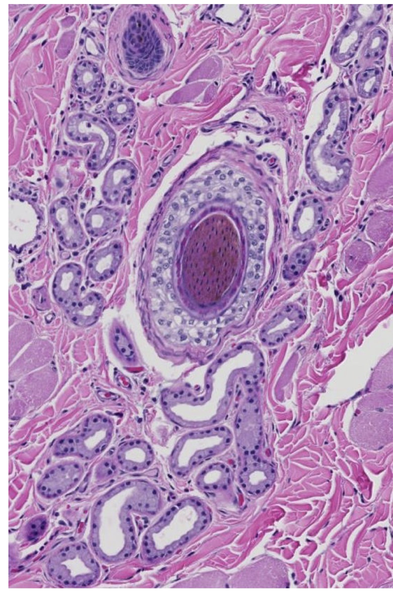 <p>Exocrine mode of secretion of sweat glands in non-haired skin</p>