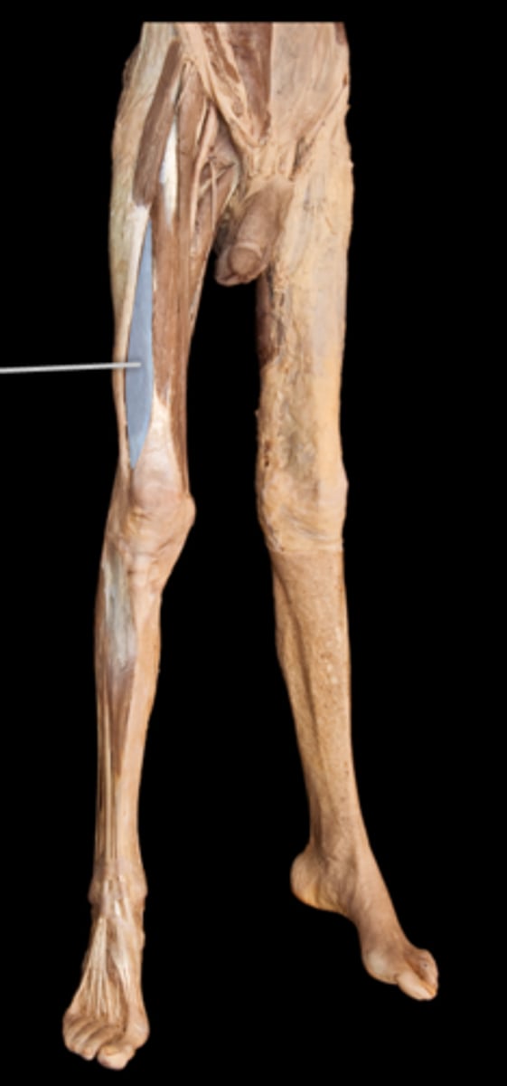 <p>What muscle is this?</p>