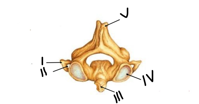 <p>What is II pointing to </p>