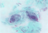 term image
