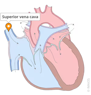 <p>Brings deoxygenated blood from the head and arms to the heart</p>