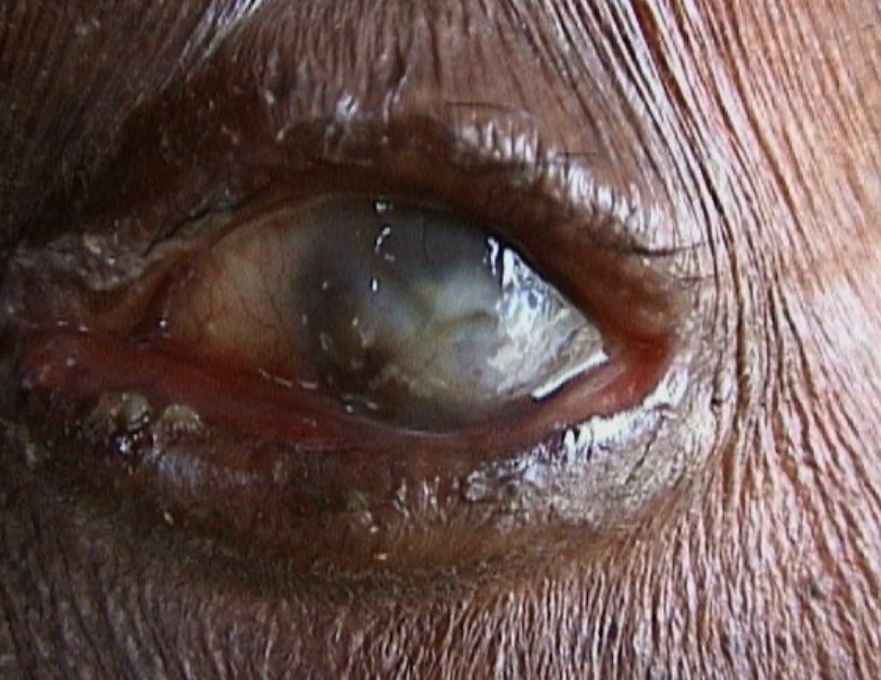 <p>What condition is this called? What organism causes it?</p>