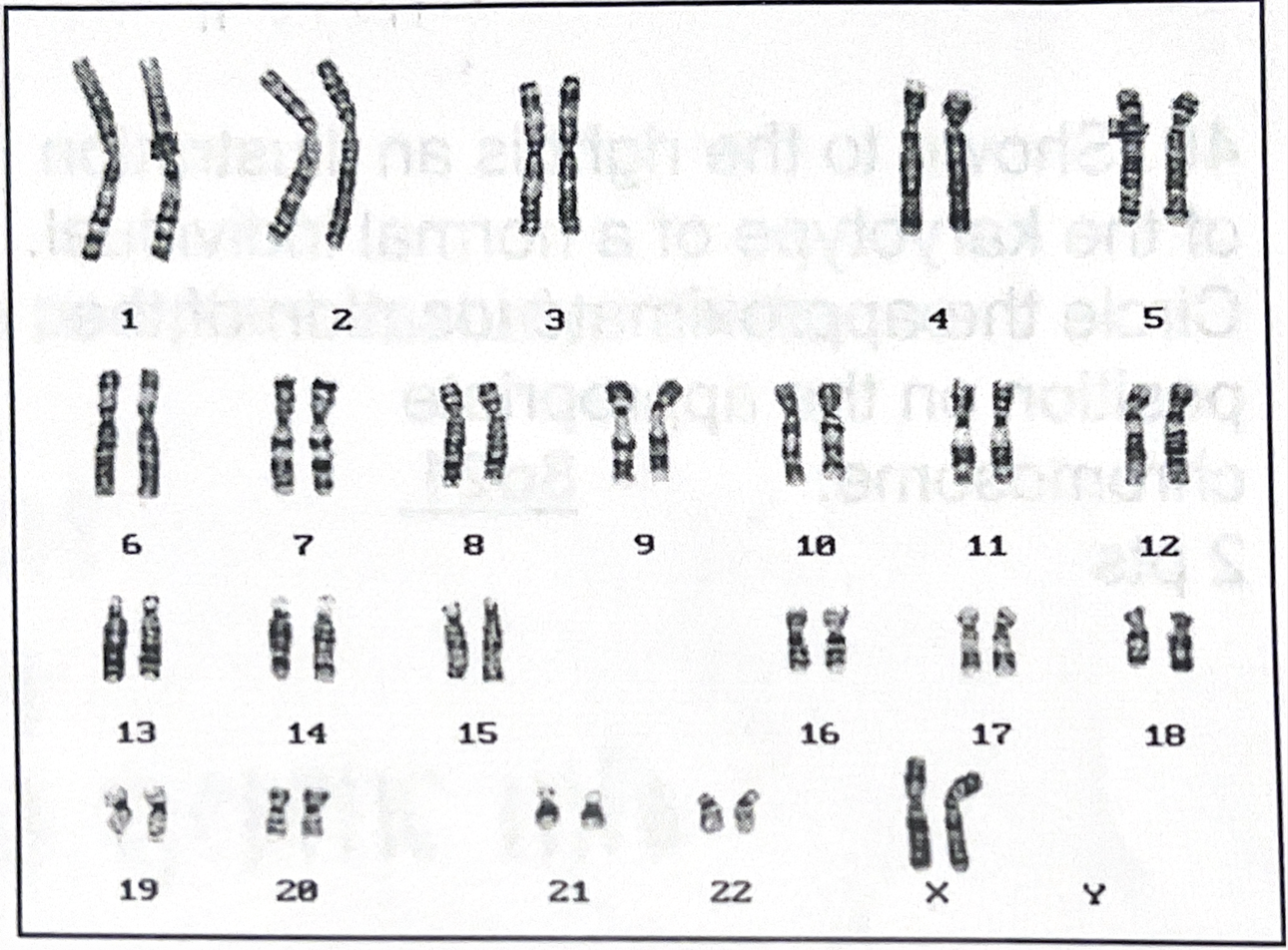<p>examine the karyotype</p>